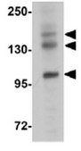 Anti-PRDM16 Antibody from rabbit, purified by affinity chromatography
