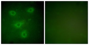 抗-角蛋白14 兔抗 affinity isolated antibody