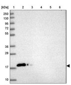 Anti-CALM1 antibody produced in rabbit Prestige Antibodies® Powered by Atlas Antibodies, affinity isolated antibody, buffered aqueous glycerol solution