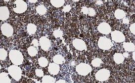 抗-Iba1/AIF1抗体，克隆16B14，ZooMAb®兔单克隆抗体 recombinant, expressed in HEK 293 cells