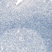 Monoclonal Anti-PRL antibody produced in mouse Prestige Antibodies® Powered by Atlas Antibodies, clone CL6550, purified immunoglobulin, buffered aqueous glycerol solution