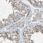 Anti-PCNT antibody produced in rabbit Prestige Antibodies® Powered by Atlas Antibodies, affinity isolated antibody, buffered aqueous glycerol solution, Ab2