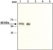 Anti-Calsequestrin-1 ~1.6 mg/mL, affinity isolated antibody, buffered aqueous solution