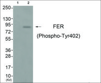 Anti-phospho-FER (pTyr402) antibody produced in rabbit affinity isolated antibody