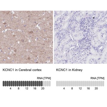 Anti-KCNC1 antibody produced in rabbit Prestige Antibodies® Powered by Atlas Antibodies, affinity isolated antibody, buffered aqueous glycerol solution