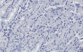 Anti-RBPJ Antibody, clone 2D10 ZooMAb® Rabbit Monoclonal recombinant, expressed in HEK 293 cells