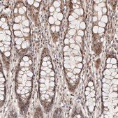 Anti-WRN antibody produced in rabbit Prestige Antibodies® Powered by Atlas Antibodies, affinity isolated antibody, buffered aqueous glycerol solution