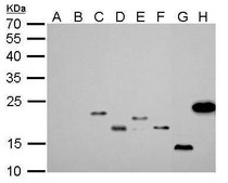 单克隆抗 6X His 标签 小鼠抗 clone GT161, affinity isolated antibody