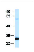 Anti-SOD2 antibody produced in rabbit affinity isolated antibody