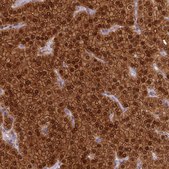 Anti-PVALB antibody produced in rabbit Prestige Antibodies® Powered by Atlas Antibodies, affinity isolated antibody, buffered aqueous glycerol solution