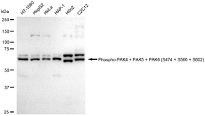 Anti-phospho-PAK4 /PAK5 /PAK6 (Ser474 /Ser560/ Ser602) Antibody, clone 24GB445, Rabbit Monoclonal clone 24GB445, recombinant rabbit monoclonal, expressed in HEK293 cells