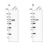 Anti-TGM2 antibody produced in rabbit Prestige Antibodies® Powered by Atlas Antibodies, affinity isolated antibody, buffered aqueous glycerol solution