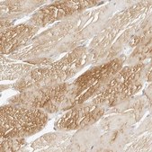Anti-MYBPC1 antibody produced in rabbit Prestige Antibodies® Powered by Atlas Antibodies, affinity isolated antibody, buffered aqueous glycerol solution
