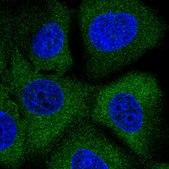 Anti-MAP2K2 antibody produced in rabbit Prestige Antibodies® Powered by Atlas Antibodies, affinity isolated antibody, buffered aqueous glycerol solution