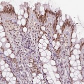 Anti-HDAC1 antibody produced in rabbit Prestige Antibodies® Powered by Atlas Antibodies, affinity isolated antibody, buffered aqueous glycerol solution