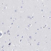 抗-DCN 兔抗 Prestige Antibodies® Powered by Atlas Antibodies, affinity isolated antibody, buffered aqueous glycerol solution