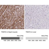 Anti-TNNT2 antibody produced in rabbit Prestige Antibodies® Powered by Atlas Antibodies, affinity isolated antibody, buffered aqueous glycerol solution