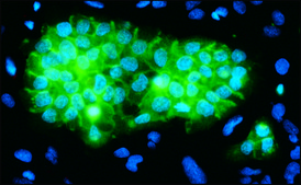 Monoclonal Anti-Epidermal Growth Factor Receptor antibody produced in mouse clone 29.1, ascites fluid