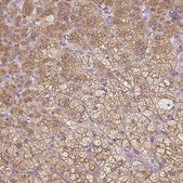 Anti-SOAT1 antibody produced in rabbit Prestige Antibodies® Powered by Atlas Antibodies, affinity isolated antibody, buffered aqueous glycerol solution