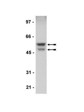 Anti-GSK3α/β Antibody, rabbit monoclonal Upstate®, from rabbit