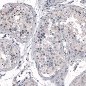 Monoclonal Anti-CDKL5 antibody produced in mouse Prestige Antibodies® Powered by Atlas Antibodies, clone CL4888, purified immunoglobulin, buffered aqueous glycerol solution