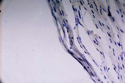 Anti-Sodium Channel Antibody, Voltage Gated, Pan (SP19 Segment) Chemicon®, from rabbit