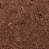 Monoclonal Anti-Adam10 Antibody Produced In Mouse Prestige Antibodies® Powered by Atlas Antibodies, clone CL13814, affinity isolated antibody, buffered aqueous glycerol solution