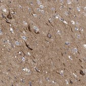 Anti-THRA antibody produced in rabbit Prestige Antibodies® Powered by Atlas Antibodies, affinity isolated antibody, buffered aqueous glycerol solution