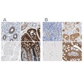 Anti-SLC9A3R1 antibody produced in rabbit Prestige Antibodies® Powered by Atlas Antibodies, affinity isolated antibody, buffered aqueous glycerol solution