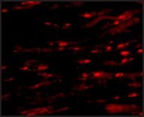 Anti-ASAH1 antibody produced in rabbit affinity isolated antibody, buffered aqueous solution