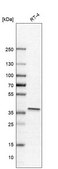 Anti-NFKBIA antibody produced in rabbit Prestige Antibodies® Powered by Atlas Antibodies, affinity isolated antibody, buffered aqueous glycerol solution