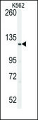 Anti-LATS1 (N-term) antibody produced in rabbit IgG fraction of antiserum, buffered aqueous solution