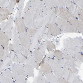 Anti-MYO1C antibody produced in rabbit Prestige Antibodies® Powered by Atlas Antibodies, affinity isolated antibody, buffered aqueous glycerol solution