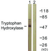 Anti-Tryptophan Hydroxylase antibody produced in rabbit affinity isolated antibody