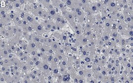 Anti-MRP2 Antibody, clone 1B2 ZooMAb® Rabbit Monoclonal recombinant, expressed in HEK 293 cells