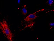 抗细胞纤连蛋白单克隆抗体 小鼠抗 clone FN-3E2, ascites fluid