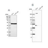 Anti-SMARCB1 antibody produced in rabbit Prestige Antibodies® Powered by Atlas Antibodies, affinity isolated antibody, buffered aqueous glycerol solution