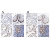 Anti-NCAPH antibody produced in rabbit Prestige Antibodies® Powered by Atlas Antibodies, affinity isolated antibody, buffered aqueous glycerol solution