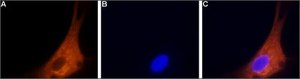 Anti-Calcium Channel (α1B Subunit) (N-type of Voltage-gated Ca2+ Channel) antibody produced in rabbit affinity isolated antibody, lyophilized powder