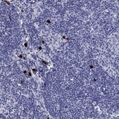Anti-CD40LG antibody produced in rabbit Prestige Antibodies® Powered by Atlas Antibodies, affinity isolated antibody, buffered aqueous glycerol solution