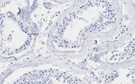 Anti-Smad2 Antibody, clone 2F15 ZooMAb® Rabbit Monoclonal recombinant, expressed in HEK 293 cells