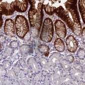 Anti-ADH7 antibody produced in rabbit Prestige Antibodies® Powered by Atlas Antibodies, affinity isolated antibody, buffered aqueous glycerol solution