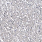 Anti-PPAT antibody produced in rabbit Prestige Antibodies® Powered by Atlas Antibodies, affinity isolated antibody, buffered aqueous glycerol solution