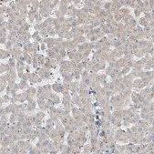 Anti-RSPH4A antibody produced in rabbit Prestige Antibodies® Powered by Atlas Antibodies, affinity isolated antibody, buffered aqueous glycerol solution
