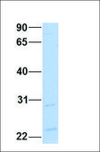 Anti-XBP1 antibody produced in rabbit affinity isolated antibody