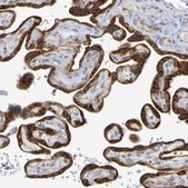 Anti-MOGS antibody produced in rabbit Prestige Antibodies® Powered by Atlas Antibodies, affinity isolated antibody, buffered aqueous glycerol solution