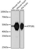 Anti-ATP1B1 antibody produced in rabbit