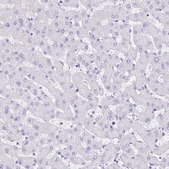Anti-GUCA2A antibody produced in rabbit Prestige Antibodies® Powered by Atlas Antibodies, affinity isolated antibody, buffered aqueous glycerol solution