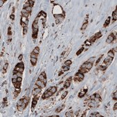 Monoclonal Anti-CS antibody produced in mouse Prestige Antibodies® Powered by Atlas Antibodies, clone CL2553, purified immunoglobulin, buffered aqueous glycerol solution