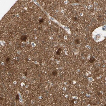 Anti-PPP3CB antibody produced in rabbit Prestige Antibodies® Powered by Atlas Antibodies, affinity isolated antibody, buffered aqueous glycerol solution